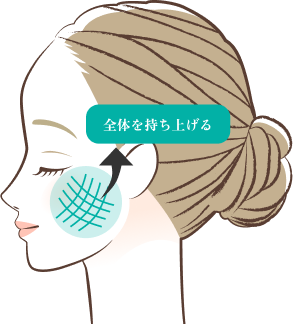 アリエル美容クリニックの糸リフト