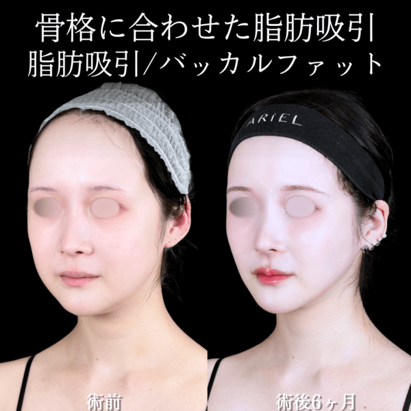 No.15039の症例写真
